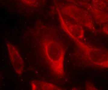Immunofluorescence staining of methanol-fixed Hela cells showing cytoplasmic staining using MKK6(Phospho-Ser207) Antibody.