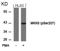 Western blot analysis of extracts from HL60 cells untreated or treated with PMA using MKK6(Phospho-Ser207) Antibody.