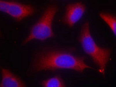 Immunofluorescence staining of methanol-fixed Hela cells using Tau(Phospho-Ser262) Antibody.