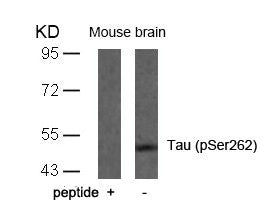 Western blot analysis of extracts from mouse brain tissue using Tau(Phospho-Ser262) Antibody and the same antibody preincubated with blocking peptide.
