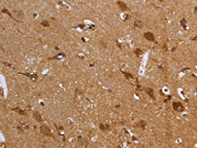 The image on the left is immunohistochemistry of paraffin-embedded Human brain  tissue using FH Antibody(FH Antibody) at dilution 1/30, on the right is treated with fusion protein. (Original magnification: ×200)Rabbit anti-Human FH Polyclonal Antibody