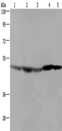Gel: 8%SDS-PAGE, Lysate: 40 μg, Lane 1-5: Hela cells, mouse liver tissue, Mouse brain tissue, Mouse heart tissue, RAW264.7 cells, Primary antibody: FH Antibody(FH Antibody) at dilution 1/600, Secondary antibody: Goat anti rabbit IgG at 1/8000 dilution, Exposure time: 20 secondsRabbit anti-Human FH Polyclonal Antibody