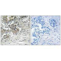 Immunohistochemistry analysis of paraffin-embedded human prostate carcinoma tissue using Claudin 7 (Ab-210) antibody.Rabbit anti-Human CLDN7 Polyclonal Antibody