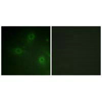 Immunofluorescence analysis of HeLa cells, using Neutrophil Cytosol Factor 1 (Ab-304) antibody.Rabbit anti-Human NCF1 Polyclonal Antibody
