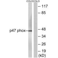 Western blot analysis of extracts from colo cells, using Neutrophil Cytosol Factor 1 (Ab-304) antibody.Rabbit anti-Human NCF1 Polyclonal Antibody