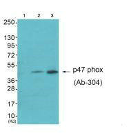 Western blot analysis of extracts from HepG2 cells (Lane 2) and Jurket cells (Lane 3), using Neutrophil Cytosol Factor 1 (Ab-304) antiobdy. The lane on the left is treated with synthesized peptide.Rabbit anti-Human NCF1 Polyclonal Antibody
