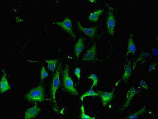 Immunofluorescent analysis of Hela cells using KARS Antibody at dilution of 1:100 and Alexa Fluor 488-congugated AffiniPure Goat Anti-Rabbit IgG(H+L)