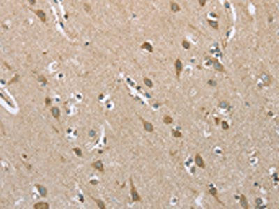 The image on the left is immunohistochemistry of paraffin-embedded Human brain  tissue using ECHS1 Antibody(ECHS1 Antibody) at dilution 1/20, on the right is treated with fusion protein. (Original magnification: ×200)Rabbit anti-Human ECHS1 Polyclonal Antibody