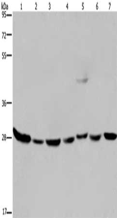 Gel: 8%SDS-PAGE, Lysate: 40 μg, Lane 1-7: Human liver tissue, 293T cells, MCF7 cells, PC3 cells, HepG2 cells, human fetal liver tissue, hela cells, Primary antibody: ECHS1 Antibody(ECHS1 Antibody) at dilution 1/200, Secondary antibody: Goat anti rabbit IgG at 1/8000 dilution, Exposure time: 20 secondsRabbit anti-Human ECHS1 Polyclonal Antibody