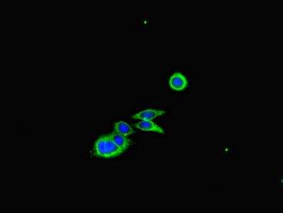 Immunofluorescent analysis of HepG2 cells using CFL1 Antibody at dilution of 1:100 and Alexa Fluor 488-congugated AffiniPure Goat Anti-Rabbit IgG(H+L)Rabbit anti-Human CFL1 Polyclonal Antibody