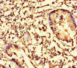Immunohistochemistry of paraffin-embedded human appendix tissue using the antibody at dilution of 1:100Rabbit anti-Human CFL1 Polyclonal Antibody