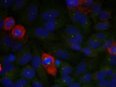 Immunofluorescence staining of methanol-fixed HeLa cells using NF-kB p65(phospho-Thr435) antibody.Rabbit anti-Human RELA Polyclonal Antibody