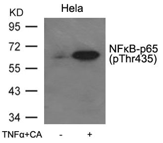 Western blot analysis of extracts from Hela cells untreated or treated with TNFa+CA using NFkB-p65(Phospho-Thr435) Antibody.Rabbit anti-Human RELA Polyclonal Antibody