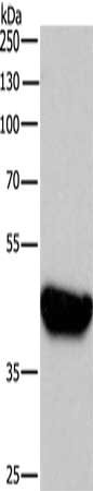 Gel: 8%SDS-PAGE, Lysate: 40 μg, Lane: A431 cells, Primary antibody: BRE Antibody(BRE Antibody) at dilution 1/750, Secondary antibody: Goat anti rabbit IgG at 1/8000 dilution, Exposure time: 30 seconds