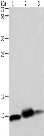 Gel: 10%SDS-PAGE, Lysate: 40 μg, Lane 1-3: Mouse heart tissue, human fetal liver tissue, Human hepatocellular carcinoma tissue, Primary antibody: COX6B1 Antibody(COX6B1 Antibody) at dilution 1/1150, Secondary antibody: Goat anti rabbit IgG at 1/8000 dilution, Exposure time: 1 minuteRabbit anti-Human COX6B1 Polyclonal Antibody