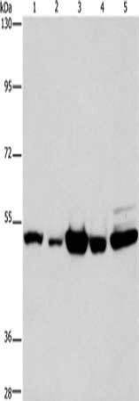 Gel: 8%SDS-PAGE, Lysate: 40 μg, Lane 1-5: Human bladder carcinoma tissue, Human brain malignant glioma tissue, A172 cells, human fetal brain tissue, hela cells, Primary antibody: PDE4D Antibody(PDE4D Antibody) at dilution 1/450, Secondary antibody: Goat anti rabbit IgG at 1/8000 dilution, Exposure time: 10 secondsRabbit anti-Human PDE4D Polyclonal Antibody
