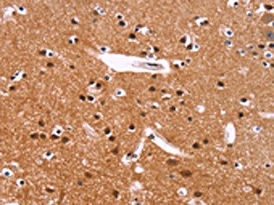 The image on the left is immunohistochemistry of paraffin-embedded Human brain  tissue using IRAK1BP1 Antibody(IRAK1BP1 Antibody) at dilution 1/40, on the right is treated with fusion protein. (Original magnification: ×200)