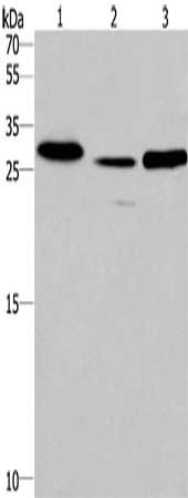 Gel: 10%SDS-PAGE, Lysate: 40 μg, Lane 1-3: Human fetal liver tissue, mouse heart tissue, human testis tissue, Primary antibody: IRAK1BP1 Antibody(IRAK1BP1 Antibody) at dilution 1/475, Secondary antibody: Goat anti rabbit IgG at 1/8000 dilution, Exposure time: 1 minute