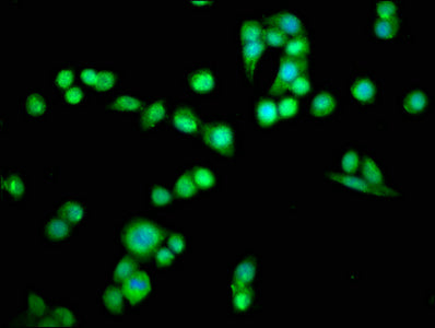 Immunofluorescence staining of PC-3 cells with PDCD6 Antibody at 1:66, counter-stained with DAPI. The cells were fixed in 4% formaldehyde, permeabilized using 0.2% Triton X-100 and blocked in 10% normal Goat Serum. The cells were then incubated with the antibody overnight at 4°C. The secondary antibody was Alexa Fluor 488-congugated AffiniPure Goat Anti-Rabbit IgG(H+L).Rabbit anti-Human PDCD6 Polyclonal Antibody