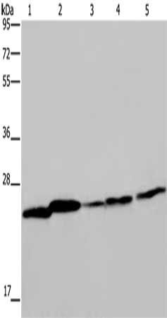 Gel: 10%SDS-PAGE, Lysate: 40 μg, Lane 1-5: Mouse spleen tissue, A375 cells, A549 cells, HT29 cells, Hela cells, Primary antibody: ARHGDIA Antibody(ARHGDIA Antibody) at dilution 1/350, Secondary antibody: Goat anti rabbit IgG at 1/8000 dilution, Exposure time: 10 secondsRabbit anti-Human ARHGDIA Polyclonal Antibody