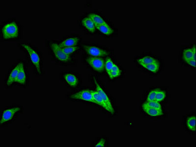 Immunofluorescent analysis of HepG2 cells using MAP2K2 Antibody at dilution of 1:100 and Alexa Fluor 488-congugated AffiniPure Goat Anti-Rabbit IgG(H+L)