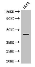 Western Blot  | Positive WB detected in: HL60 whole cell lysate  | All lanes: MAP2K2 antibody at 2.8µg/ml  | Secondary  | Goat polyclonal to rabbit IgG at 1/50000 dilution  | Predicted band size: 45 kDa  | Observed band size: 45 kDa