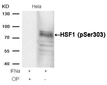 Western blot analysis of extracts from Hela cells, treated with IFNa or calf intestinal phosphatase (CIP), using HSF1 (phospho-Ser303) Antibody.Rabbit anti-Human HSF1 Polyclonal Antibody