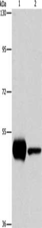 Gel: 10%SDS-PAGE, Lysate: 40 μg, Lane 1-2: K562 cells, mouse brain tissue, Primary antibody: PIP4K2A Antibody(PIP4K2A Antibody) at dilution 1/1150, Secondary antibody: Goat anti rabbit IgG at 1/8000 dilution, Exposure time: 10 secondsRabbit anti-Human PIP4K2A Polyclonal Antibody