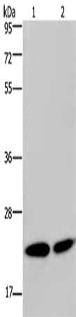Gel: 8%SDS-PAGE, Lysate: 40 μg, Lane 1-2: Hela cells, Jurkat cells, Primary antibody: NPM3 Antibody(NPM3 Antibody) at dilution 1/300, Secondary antibody: Goat anti rabbit IgG at 1/8000 dilution, Exposure time: 10 secondsRabbit anti-Human NPM3 Polyclonal Antibody