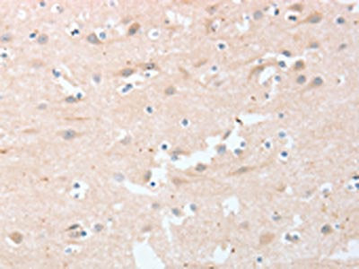 The image on the left is immunohistochemistry of paraffin-embedded Human brain  tissue using LY96 Antibody(LY96 Antibody) at dilution 1/20, on the right is treated with fusion protein. (Original magnification: ×200)