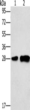 Gel: 10%SDS-PAGE, Lysate: 40 μg, Lane 1-2: Mouse liver tissue, 231 cells, Primary antibody: LY96 Antibody(LY96 Antibody) at dilution 1/500, Secondary antibody: Goat anti rabbit IgG at 1/8000 dilution, Exposure time: 1 minute