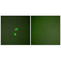 Immunofluorescence analysis of NIH/3T3 cells, using Galectin 3 antibody.