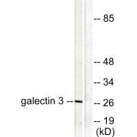 Western blot analysis of extracts from HeLa cells, using Galectin 3 antibody.