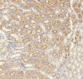 Immunohistochemical analysis of paraffin-embedded Rat-kidney tissue. 1,TGFβ RI (phospho Ser165) Polyclonal Antibody was diluted at 1:200(4°C,overnight). 2, Sodium citrate pH 6.0 was used for antibody retrieval(>98°C,20min). 3,Secondary antibody was diluted at 1:200(room temperature, 30min).Rabbit anti-Human Phospho-TGFBR1 (S165) Polyclonal Antibody