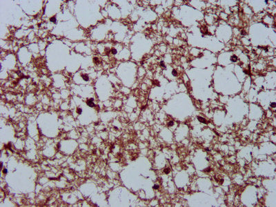 IHC image of HSPA5 Antibody diluted at 1:200 and staining in paraffin-embedded human brain tissue performed on a Leica BondTM system. After dewaxing and hydration, antigen retrieval was mediated by high pressure in a citrate buffer (pH 6.0). Section was blocked with 10% normal goat serum 30min at RT. Then primary antibody (1% BSA) was incubated at 4°C overnight. The primary is detected by a biotinylated secondary antibody and visualized using an HRP conjugated SP system.Rabbit anti-Human HSPA5 Polyclonal Antibody