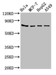 Western Blot  | Positive WB detected in: Hela whole cell lysate, MCF-7 whole cell lysate, HepG2 whole cell lysate, A549 whole cell lysate  | All lanes: HSPA5 antibody at 4µg/ml  | Secondary  | Goat polyclonal to rabbit IgG at 1/50000 dilution  | Predicted band size: 73 kDa  | Observed band size: 73 kDaRabbit anti-Human HSPA5 Polyclonal Antibody