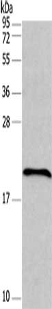 Gel: 10%SDS-PAGE, Lysate: 40 μg, Lane: Raji cells, Primary antibody: FAIM Antibody(FAIM Antibody) at dilution 1/200, Secondary antibody: Goat anti rabbit IgG at 1/8000 dilution, Exposure time: 15 secondsRabbit anti-Human FAIM Polyclonal Antibody
