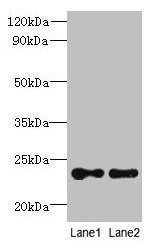 Western blot  | All lanes: TMED2 antibody at 6µg/ml  | Lane 1: HCT116 whole cell lysate  | Lane 2: Mouse ovarian tissue  | Secondary  | Goat polyclonal to rabbit IgG at 1/10000 dilution  | Predicted band size: 23 kDa  | Observed band size: 23 kDaRabbit anti-Human TMED2 Polyclonal Antibody