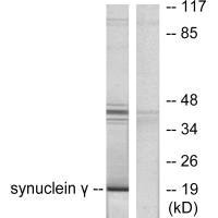Western blot analysis of extracts from HT29 cells, using Synuclein γ antibody.Rabbit anti-Human SNCG Polyclonal Antibody
