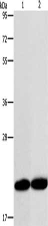 Gel: 12%SDS-PAGE, Lysate: 40 μg, Lane 1-2: MCF7 cells, A375 cells, Primary antibody: RAB26 Antibody(RAB26 Antibody) at dilution 1/200, Secondary antibody: Goat anti rabbit IgG at 1/8000 dilution, Exposure time: 5 secondsRabbit anti-Human RAB26 Polyclonal Antibody