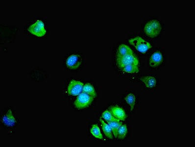 Immunofluorescent analysis of MCF-7 cells using BTBD2 Antibody at dilution of 1:100 and Alexa Fluor 488-congugated AffiniPure Goat Anti-Rabbit IgG(H+L)