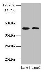 Western blotAll lanes: BTBD2 antibody at 6µg/mlLane 1: Hela whole cell lysateLane 2: MDA-MB-231 whole cell lysateSecondaryGoat polyclonal to rabbit IgG at 1/10000 dilutionPredicted band size: 56, 23 kDaObserved band size: 42 kDa
