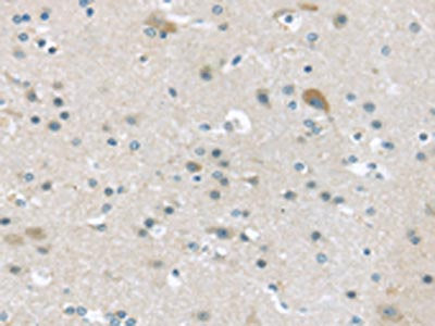 The image on the left is immunohistochemistry of paraffin-embedded Human brain tissue using VGF Antibody(VGF Antibody) at dilution 1/45, on the right is treated with synthetic peptide. (Original magnification: ×200)Rabbit anti-Human VGF Polyclonal Antibody