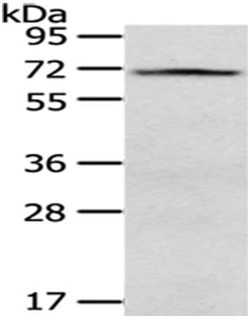 Gel: 8%SDS-PAGE,Lysate: 40 μg,,Primary antibody: VGF Antibody(VGF Antibody) at dilution 1/500 dilution,Secondary antibody: Goat anti rabbit IgG at 1/8000 dilution,Exposure time: 1 minuteRabbit anti-Human VGF Polyclonal Antibody
