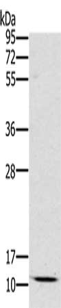 Gel: 10%SDS-PAGE, Lysate: 40 μg, Lane: Mouse kidney tissue, Primary antibody: SCGB2A1 Antibody(SCGB2A1 Antibody) at dilution 1/800, Secondary antibody: Goat anti rabbit IgG at 1/8000 dilution, Exposure time: 10 minutesRabbit anti-Human SCGB2A1 Polyclonal Antibody