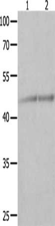 Gel: 10%SDS-PAGE, Lysate: 40 μg, Lane 1-2: Jurkat cells, K562 cells, Primary antibody: NCK1 Antibody(NCK1 Antibody) at dilution 1/600, Secondary antibody: Goat anti rabbit IgG at 1/8000 dilution, Exposure time: 1 minuteRabbit anti-Human NCK1 Polyclonal Antibody