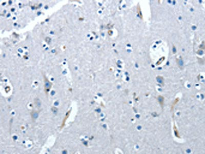 The image on the left is immunohistochemistry of paraffin-embedded Human brain  tissue using PRKX Antibody(PRKX Antibody) at dilution 1/20, on the right is treated with synthetic peptide. (Original magnification: ×200)Rabbit anti-Human PRKX Polyclonal Antibody