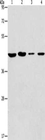 Gel: 10%SDS-PAGE, Lysate: 40 μg, Lane 1-4: A549 cells, Jurkat cells, 293T cells, K562 cells, Primary antibody: PRKX Antibody(PRKX Antibody) at dilution 1/200, Secondary antibody: Goat anti rabbit IgG at 1/8000 dilution, Exposure time: 20 secondsRabbit anti-Human PRKX Polyclonal Antibody