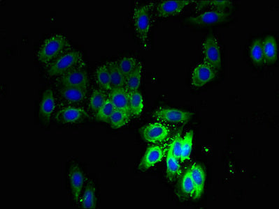 Immunofluorescent analysis of HepG2 cells using SCAMP3 Antibody at dilution of 1:100 and Alexa Fluor 488-congugated AffiniPure Goat Anti-Rabbit IgG(H+L)Rabbit anti-Human SCAMP3 Polyclonal Antibody