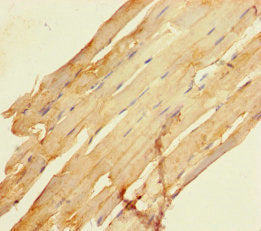 Immunohistochemistry of paraffin-embedded human skeletal muscle tissue using SCAMP3 Antibody at dilution of 1:100Rabbit anti-Human SCAMP3 Polyclonal Antibody